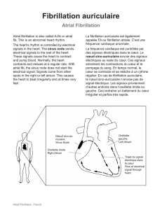 Atrial Fibrillation - French - Health Information Translations