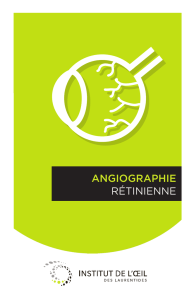 ANGIOGRAPHIE RÉTINIENNE
