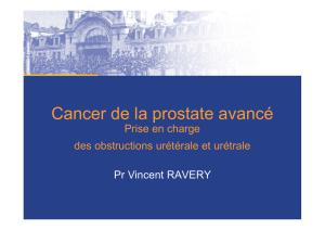Cancer de la prostate avancé - Service d`Urologie de l`hôpital Bichat
