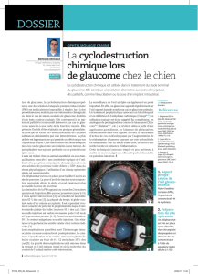 La cyclodestruction chimique lors de glaucome