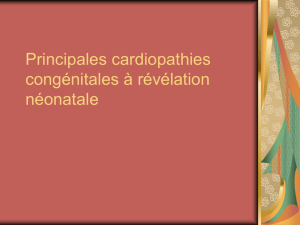 Principales cardiopathies congénitales à révélation - FMP-UEH