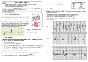 AE7 electrocardiogramme