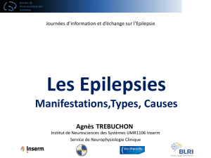 EPILEPSIE_Journée d`echange 2702 Dr A Trébuchon