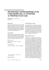 metastase choroidienne d′un carcinome de la