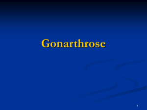 Gonarthrose