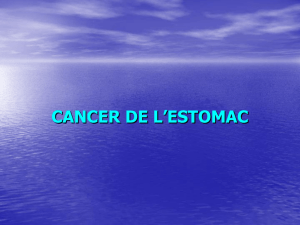 CANCER DE L`ESTOMAC