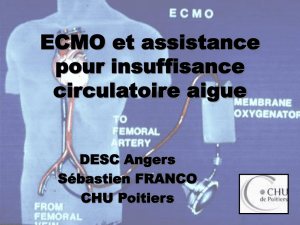 ECMO et assistance pour insuffisance circulatoire aigue DESC