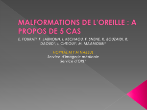 MALFORMATIONS DE L`OREILLE : A PROPOS DE 5 CAS