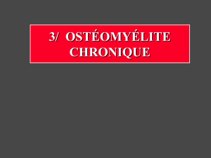 3/ ostéomyélite chronique