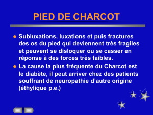 Charcot - Le Pied Diabétique