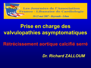 RA SERRE ASYMPTOMATIQUE - Cardiologie francophone