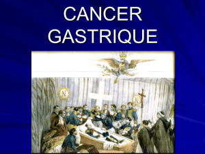 CANCER GASTRIQUE