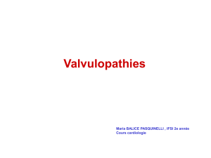 Le cours sur les valvulopathies