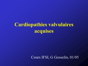 Cardiopathies valvulaires acquises 1
