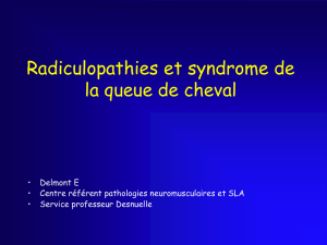 Radiculopathies et syndrome de la queue de cheval