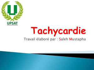 Tachycardie