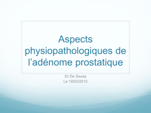 Aspects physiopathologiques de l*adénome prostatique