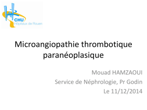 Microangiopathie thrombotique paranéoplasique