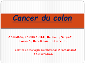 Cancer du colon