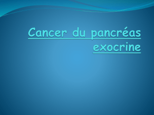Cancer du pancréas exocrine