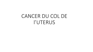 CANCER DU COL DE l*UTERUS