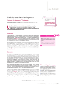 Maladies virales> Nodule, face dorsale du pouce – Nodule, the