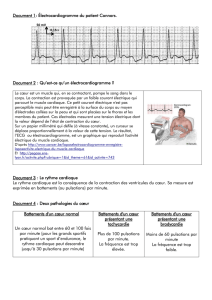 Document 1: Électrocardiogramme du patient Connors. Document 2
