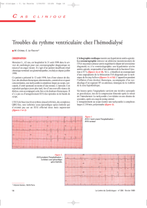 Trouble du rythme ventriculaire chez l hémodialysé