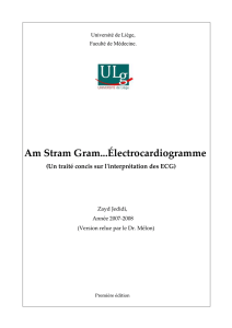 Am Stram Gram...Électrocardiogramme