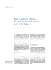 Neuropathies optiques ischémiques antérieures non artéritiques