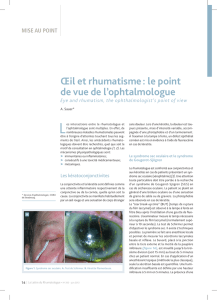 Œil et rhumatisme : le point de vue de l`ophtalmologue