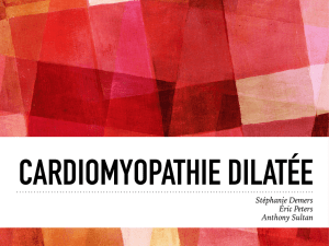 Cardiomyopathie Dilatée