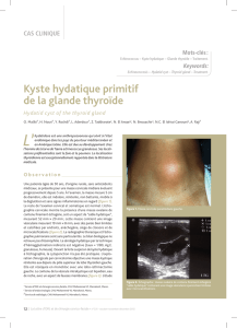 Kyste hydatique primitif de la glande thyroïde