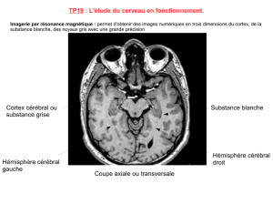 TP19 : L`étude du cerveau en fonctionnement. Coupe axiale ou