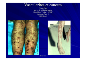 vascularite - Groupe Français d`Etude des Vascularites