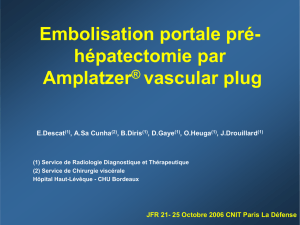 Embolisation portale pré- hépatectomie par Amplatzer® vascular plug