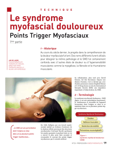 Le syndrome myofascial douloureux