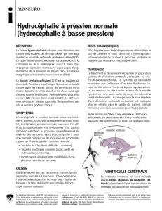 hydrocéphalie à basse pression - Neuro
