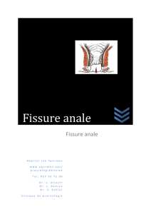 Fissure anale - Jan Yperman Ziekenhuis