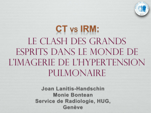 CT vs IRM: Le clash des grands esprits dans le monde de l`imagerie