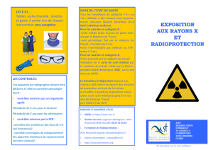 EXPOSITION AUX RAYONS X ET RADIOPROTECTION