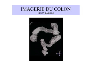 IMAGERIE DU COLON II B.ppt [Lecture seule] [Mode