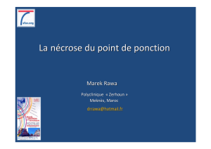 NECROSE DU PdP, Montpellier 2015.pptx