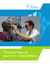 Traitement laser du glaucome : trabéculoplastie