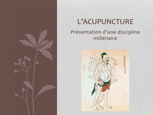 l`acupuncture