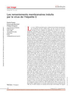 Les remaniements membranaires induits par le virus de l`hépatite C