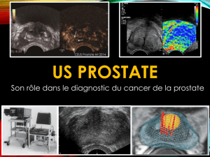 Us prostate-VAN NIEUWENHOVE