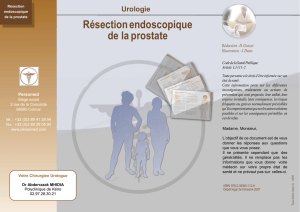 Résection endoscopique de la prostate