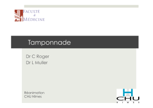Tamponnade - Ultrasonographie