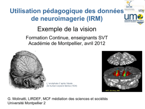 Utilisation pédagogique des données de neuroimagerie (IRM
